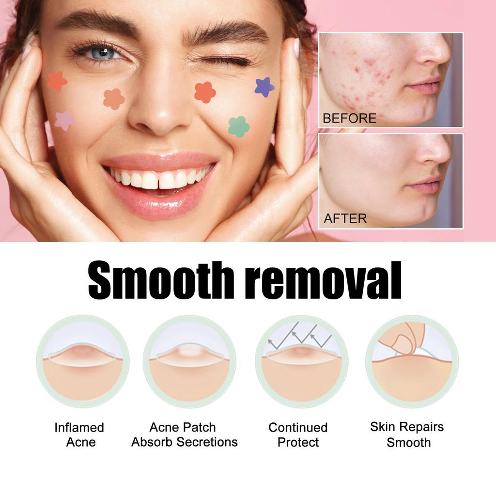 Large Capacity Pimple Patches, Colorful Cute Zit Covers,Hydrocolloid Acne Patches With Tea Oil, Witch Hazel, Centella Asiatica , Hyaluronic Sour