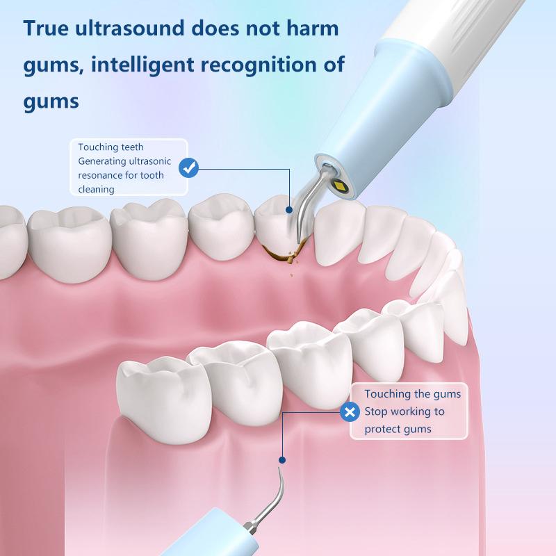 Ultrasonic Dental Calculus Scaler Cleaner Tooth Cleaning Tools Set With Auxiliary Light IPX5 Waterproof 3PCS Replacement Cleaner