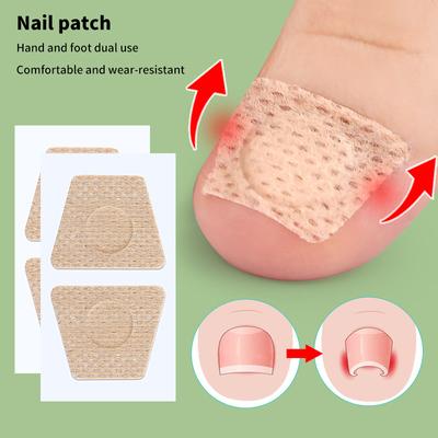 5 par nagelvårdsplåster Korrektionsplåster för inåtväxande tånagel Inåtväxande tånagelbehandling Mjuk nagelreparationsplåster Fotvårdsverktyg