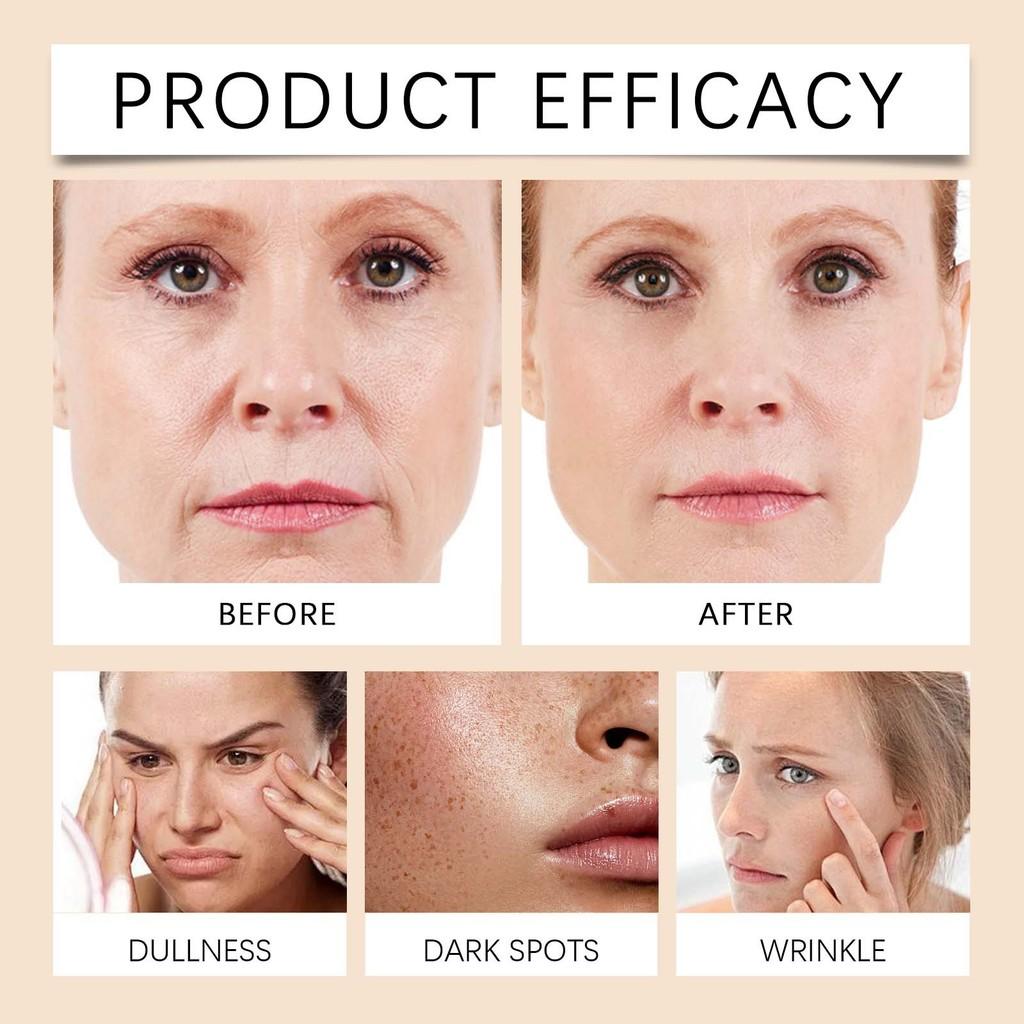 Brightening Deep Moisturizing Cream Gentle Hydration For Face And Eyes