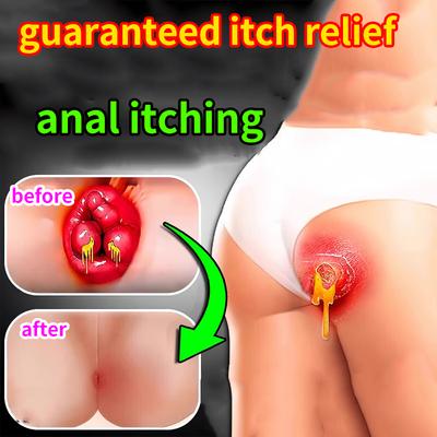 Medicated Ointment for the Relief of Anal Itching