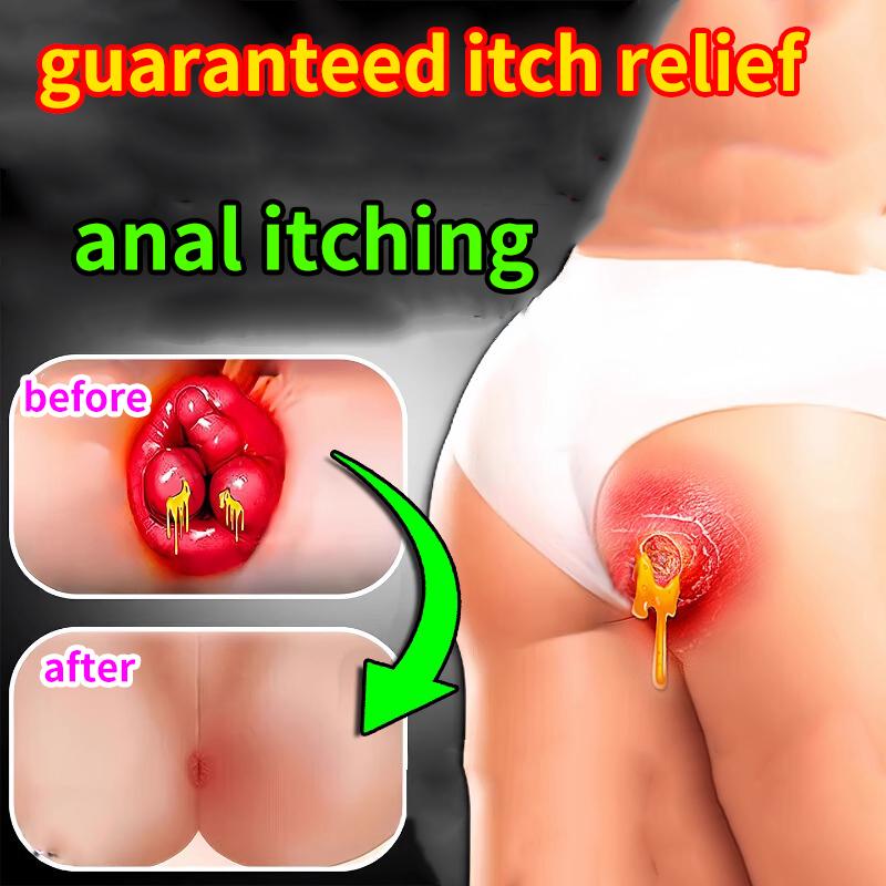 Medicated Ointment for the Relief of Anal Itching