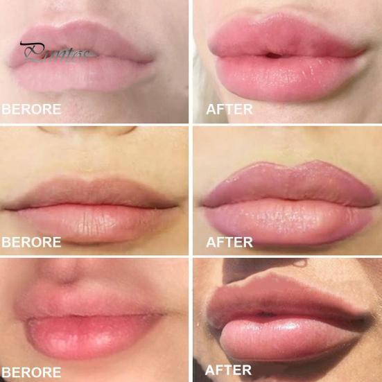 Йошкар-Ола топтық секс Жетілген орыс әйелі шешініп жатқан видео