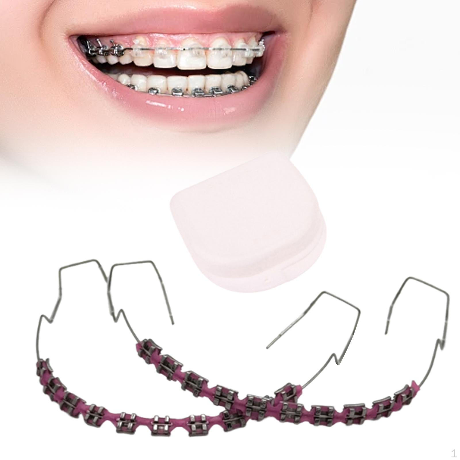 

Временное украшение для зубов, практическое применение, металлические скобки для студентов