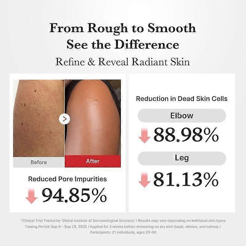 Arbutin 7% Tranexamsäure 4% Creme 50ml Aufhellend K-Beauty 50g