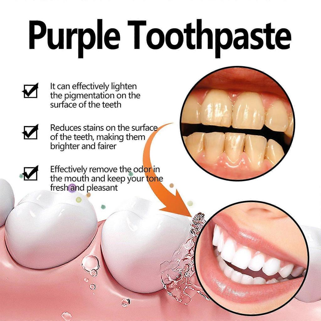 Limited time!!Oralhoe Purple Tooth Whitening Toothpaste, Deep Cleansing For Plaque And Stains, Freshens Breath