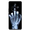 For Vivo Y300 Case 6.77” Wolf Lion Tiger Cat Capa Silicone TPU Soft Back Cover Black Cases For Vivo Y300C Case Shockproof Shell