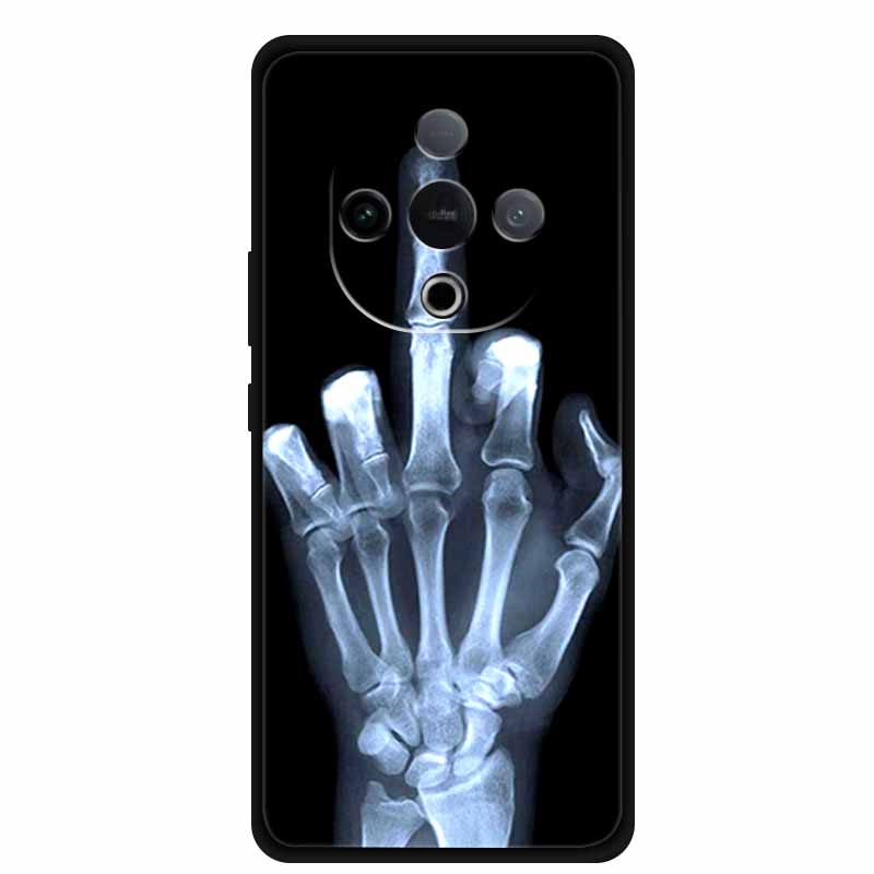 For Vivo Y300 Case 6.77” Wolf Lion Tiger Cat Capa Silicone TPU Soft Back Cover Black Cases For Vivo Y300C Case Shockproof Shell