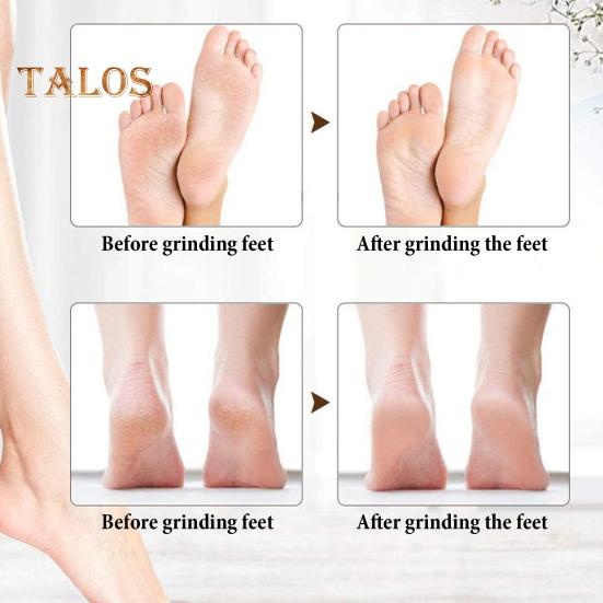 Electric Callus Remover 2-Speed Foot File for Dead Skin Hard & Cracked Heels Portable Pedicure Tool with 360 Degrees Roller Heads