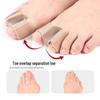 Double-Hole Toe Separator & Bunion Corrector Set | Soft Anti-Abrasion Toe Caps