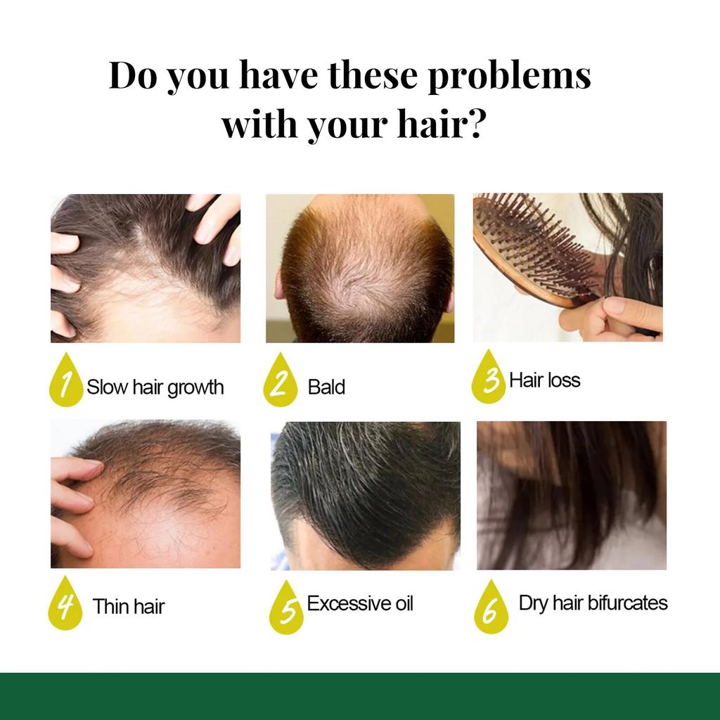 EELHOE Hair Growth Spray 7 Day Ginger Serum Scalp Damaged Treatement Prevent Hair Loss Effective Fast Growth Massage Liquid 50ml