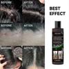 Mild Sulfate-Free Shampoo for Sensitive Scalps with Dermatitis Relief