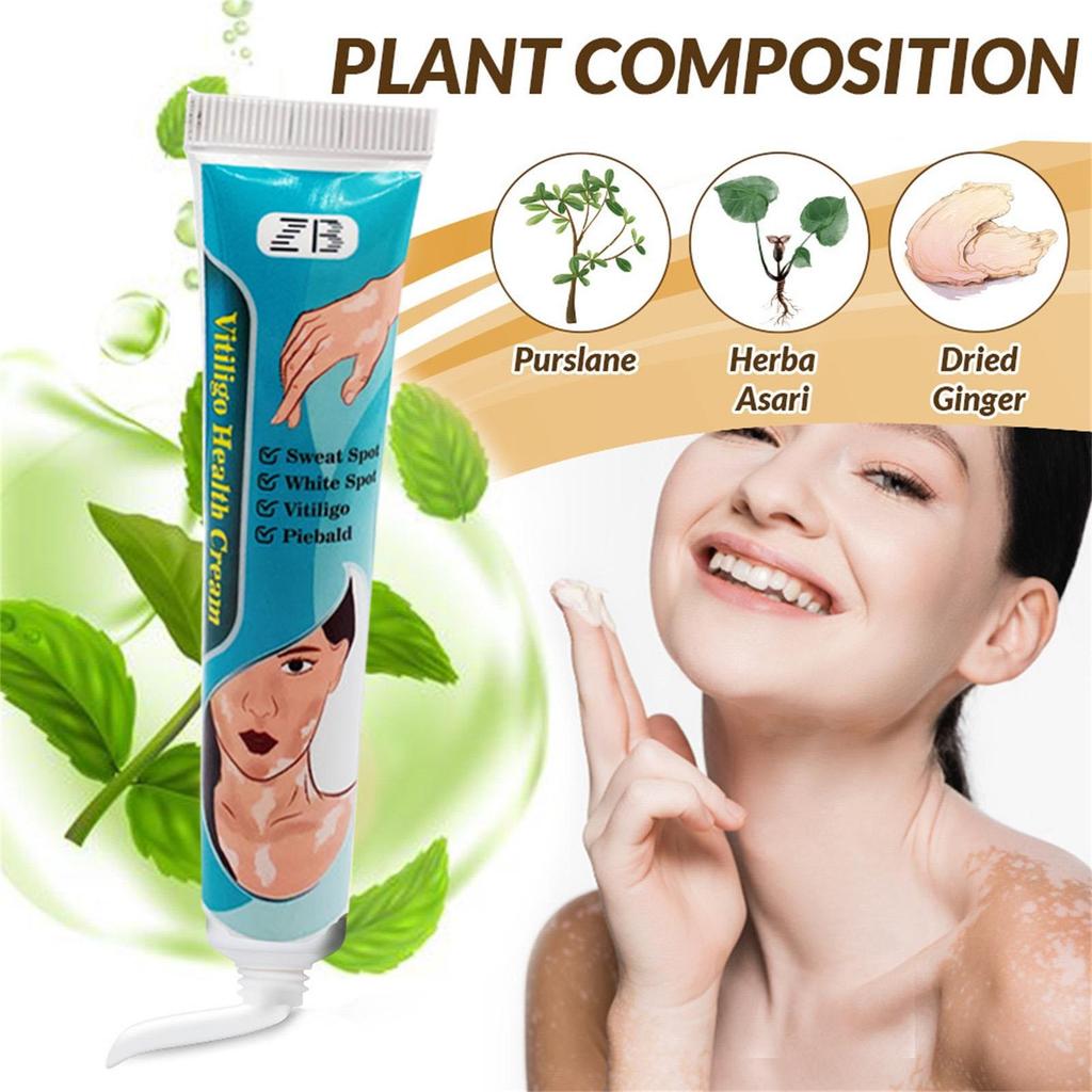 ZB Powerful Cream Treatment for Vitiligo and Skin Discoloration Reduce White Spots, Improve Skin Pigmentation