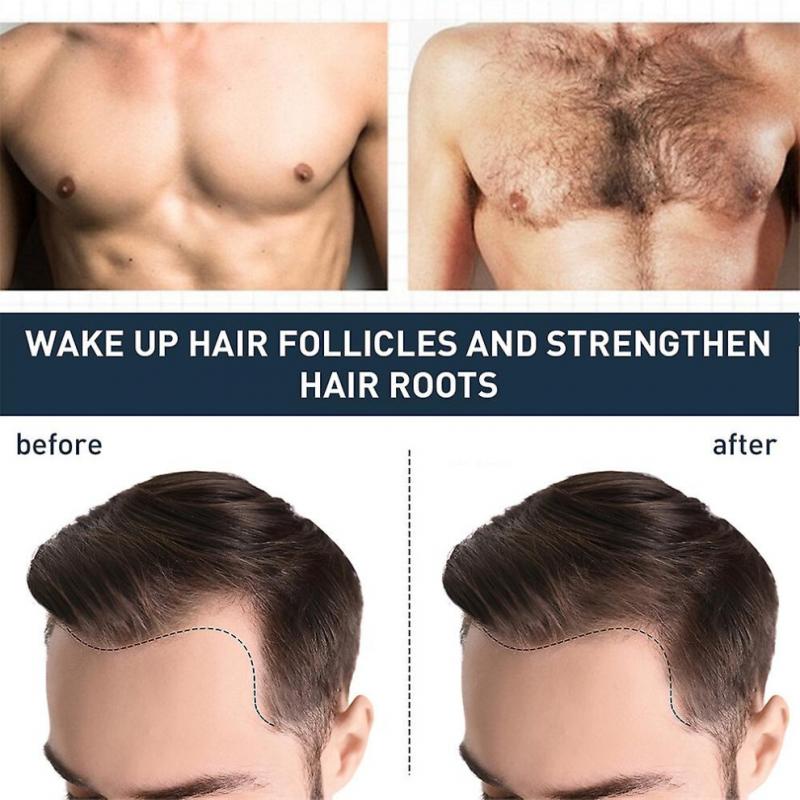 Body Hair Growth Liquid Strong Repairs And Maintenance Growth Hair Liquid Beard Chest Hair Fast Thick Growth Hair Liquid