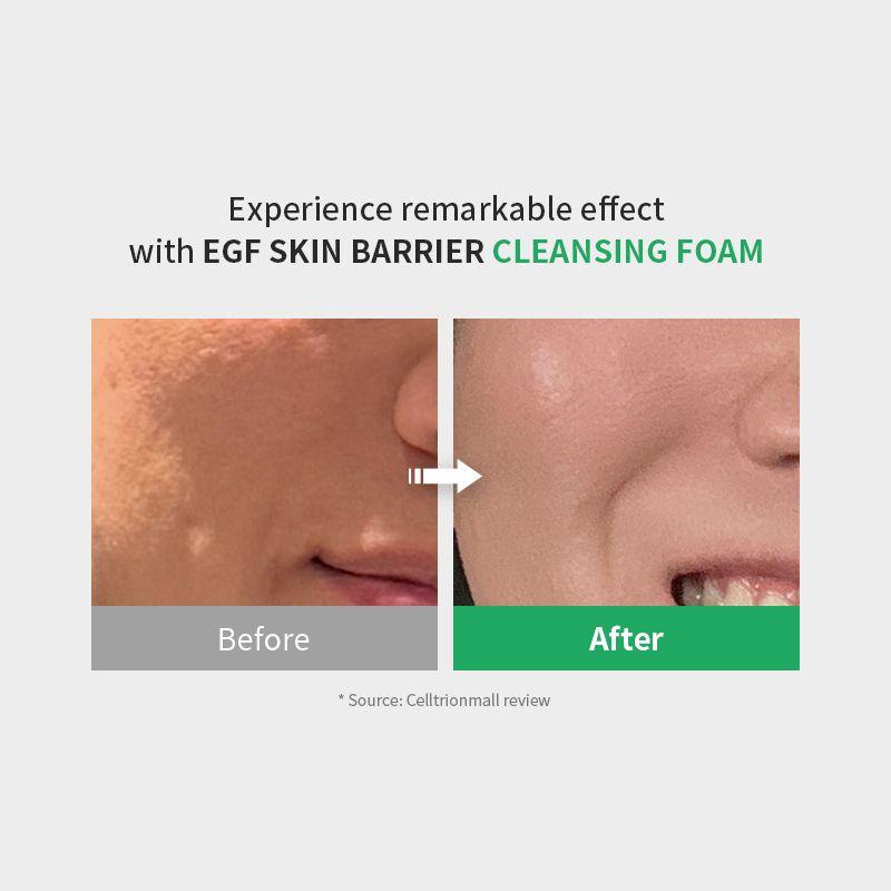 [zipiderm] EGF Skin Barrier Cleansing Foam 120ml