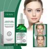 Ouhoe Water-based Salicylic Acid Pore Tightening Serum For Gentle Blackhead Removal And Skin Brightening