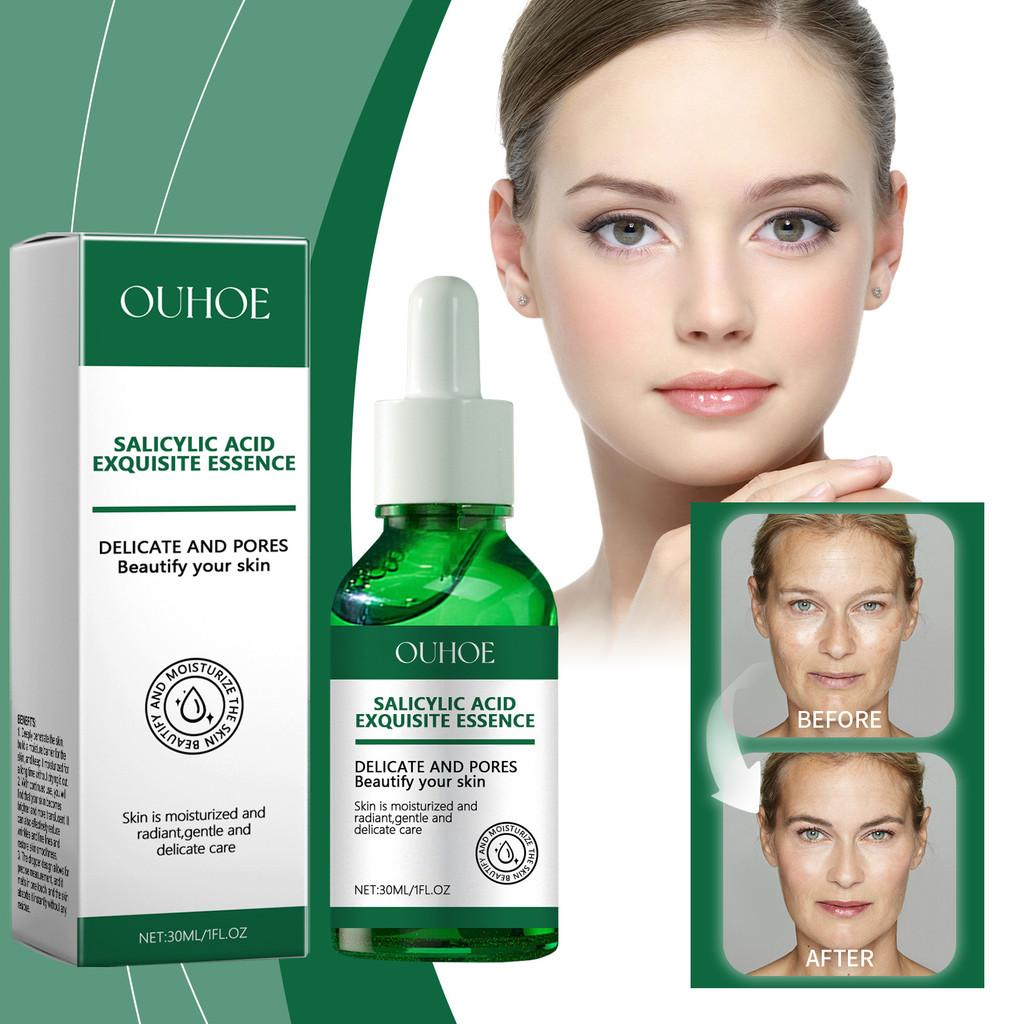 Ouhoe Water-based Salicylic Acid Pore Tightening Serum For Gentle Blackhead Removal And Skin Brightening