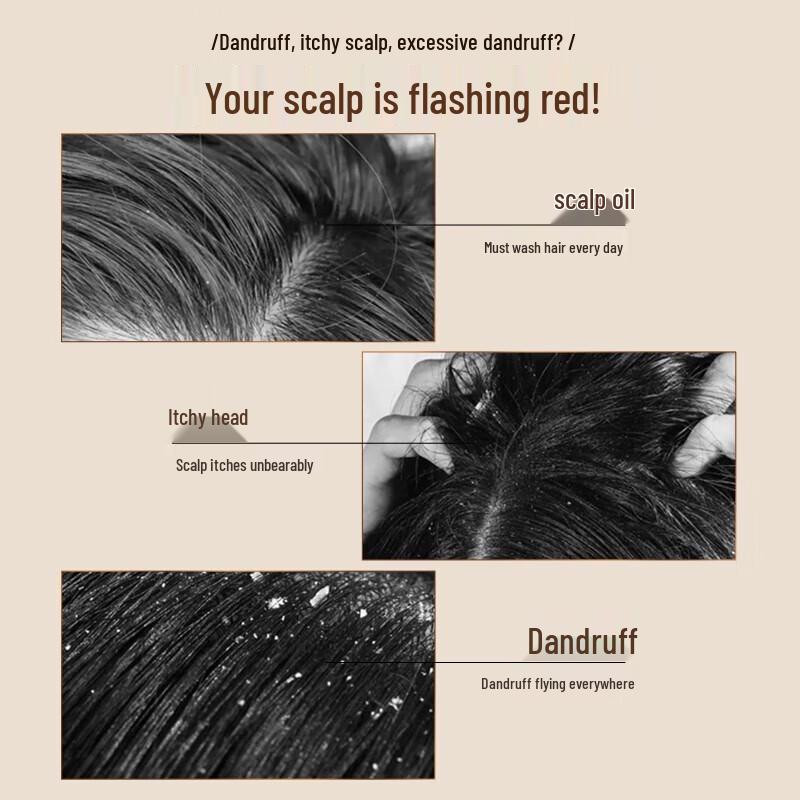 Ziyuan Silicone-Free Amino Acid & Tea Seed Anti-Dandruff Shampoo