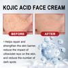 Wrinkle Remove Cream Anti-Aging Fade Fine Lines Firming Lifting Skin Fade Dark Spots Freckle Melanin Treatment Face Repair Cream