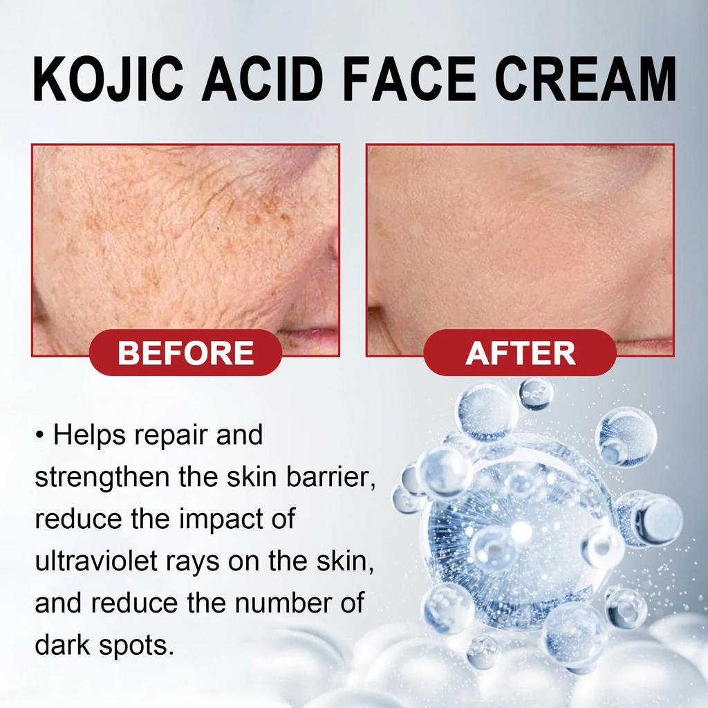 Wrinkle Remove Cream Anti-Aging Fade Fine Lines Firming Lifting Skin Fade Dark Spots Freckle Melanin Treatment Face Repair Cream