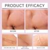 Silicone Scar Patch 4x150cm Waterproof Keloid Removal Strip Effective Scar Therapy Self-Adhesive Tape for Surgical Acne Burn