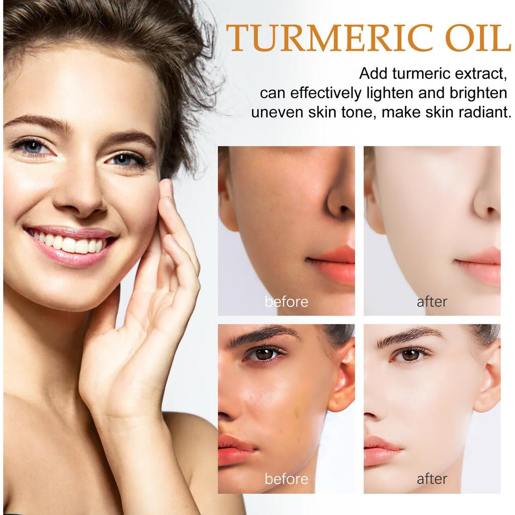 West Month Turmeric Multi-Purpose Essential Oil - 2-in-1 for Facial Brightening/Improving Dullness/Deep Hydration/Moisturizing/Hair Growth/Facial Care
