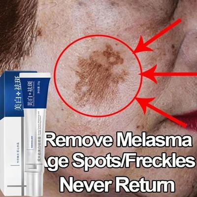 Tõhus valgendav kreem freckles eemaldab melasma tumedad laigud pleekib pigmentatsiooni niisutab heledamaks nägu Nahahooldustoode