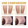 60G Varicose Vein Cream Natural Relief Promotes Healthy Circulation Vitamin K Cream for Leg Soreness Swelling