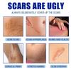 1-3x Acnes Scars Removal Cream Effectiveness Non-irritating Cream For Face
