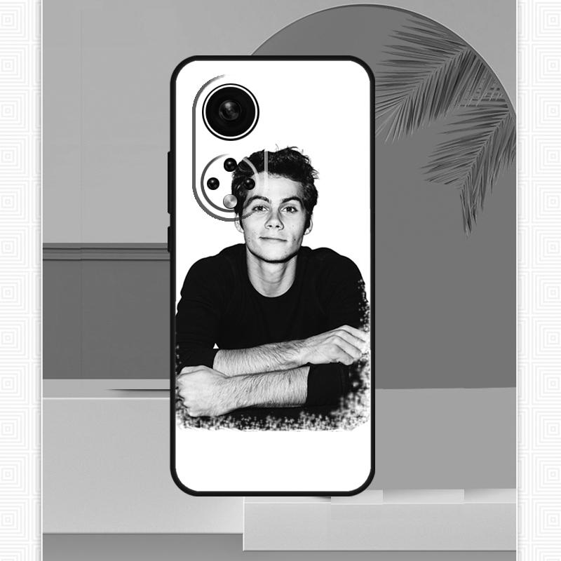 Dylan O'Brien Teen Wolf Case For Honor Magic 5 6 7 8 Pro Honor X9c X9b X9a X8b X8a X8c 50 70 90 400 200 Lite Cover
