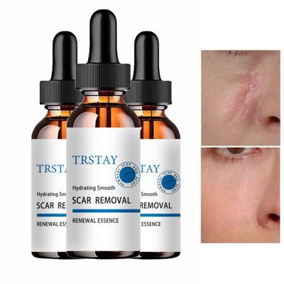 Krem do skóry krem ​​na rany płonący blaknący krem ​​chirurgia naprawa blizn pielęgnacja skóry krem ​​wybielający skórę crema para manchas de la cara