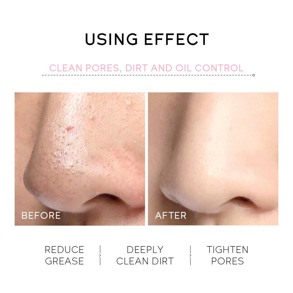 Sakura Peeling Nose Mask Deep Cleansing Oil-Control Shrink Pores Blackhead Removed Tear Off Mask Improve Roughness Skin Care