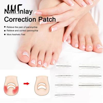 Herramientas Correctoras para Uñas Encarnadas Pedicura Recuperar Tratamiento de Uña del Pie Incrustada Parche Elástico Pegatina Pinza Rectificadora Soporte 13-20MM