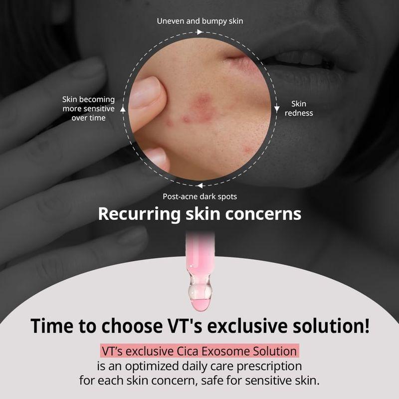 VT - Azelaic A1 Calming Ampoule