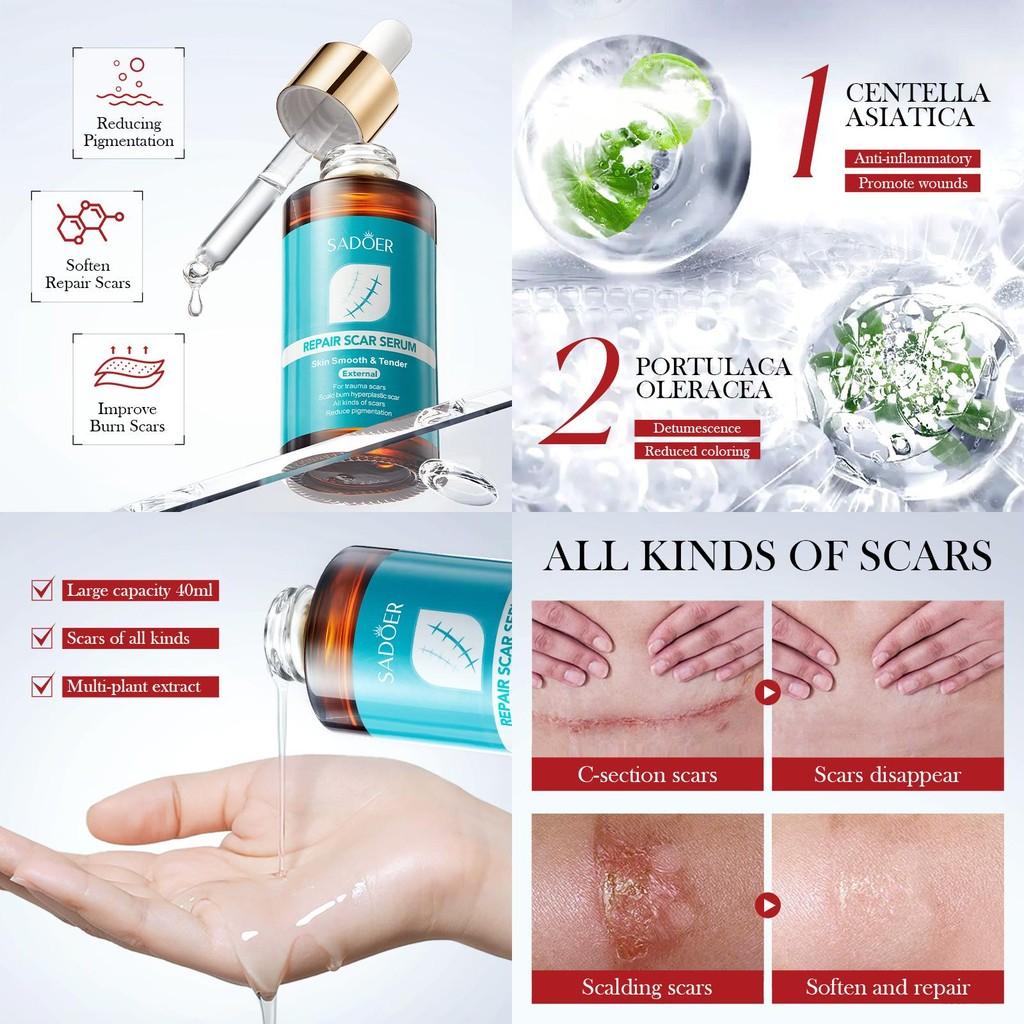 Sadoer Scar Repair Serum 40ml For All Skin Types Nourishing Brightening Essence
