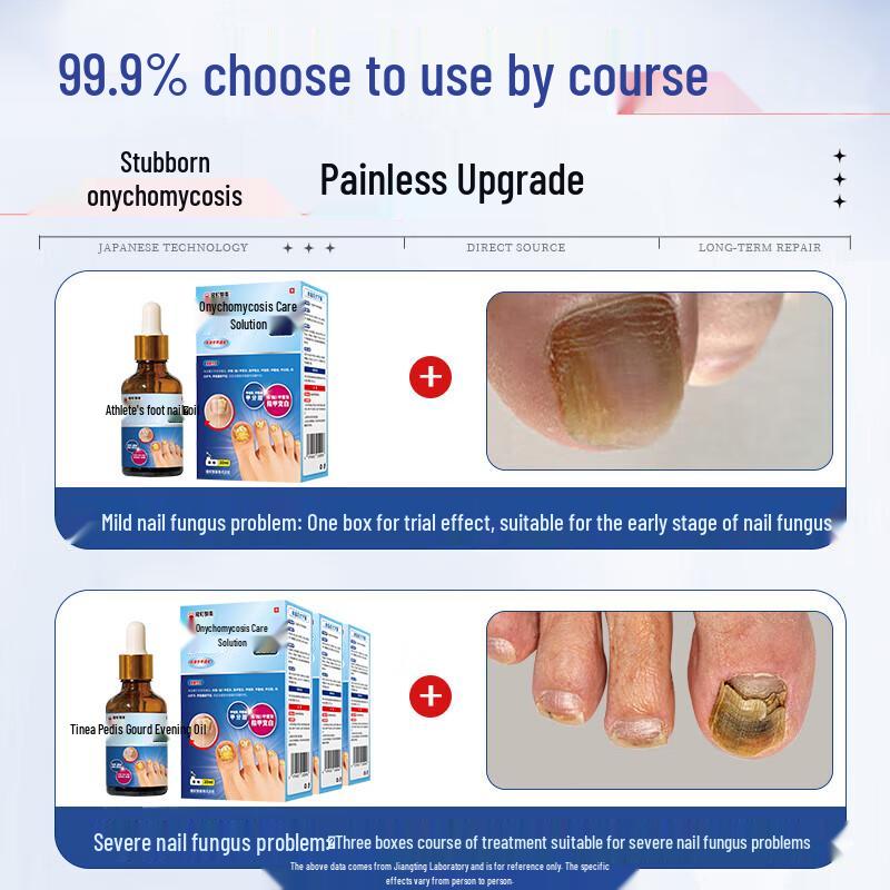 Longding Fungal Nail Repair Solution