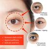 EELHOE Eye Firming Cream for Dark Circles Removal Anti Bags Under the Eyes Moisturizing Eye Contour Nourishing Eye Repair Cream
