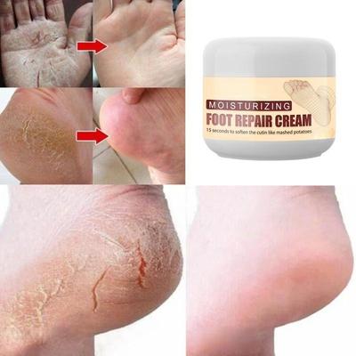 Foot Repair Cream Ενυδατική και επανορθωτική κρέμα περιποίησης ποδιών peeling φτέρνων