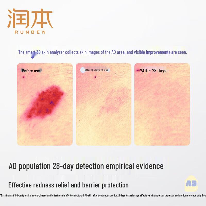 RUNBEN Infant & Toddler AD Soothing Cream