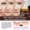 EELHOE Retinol Cream Anti-aging Firming and Brightening Skin Moisturizing Facial Skin Care Cream