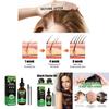 Jaysuing Castor Oil Hair Growth Serum Nourishing Moisturizing Anti Hair Loss 60ml