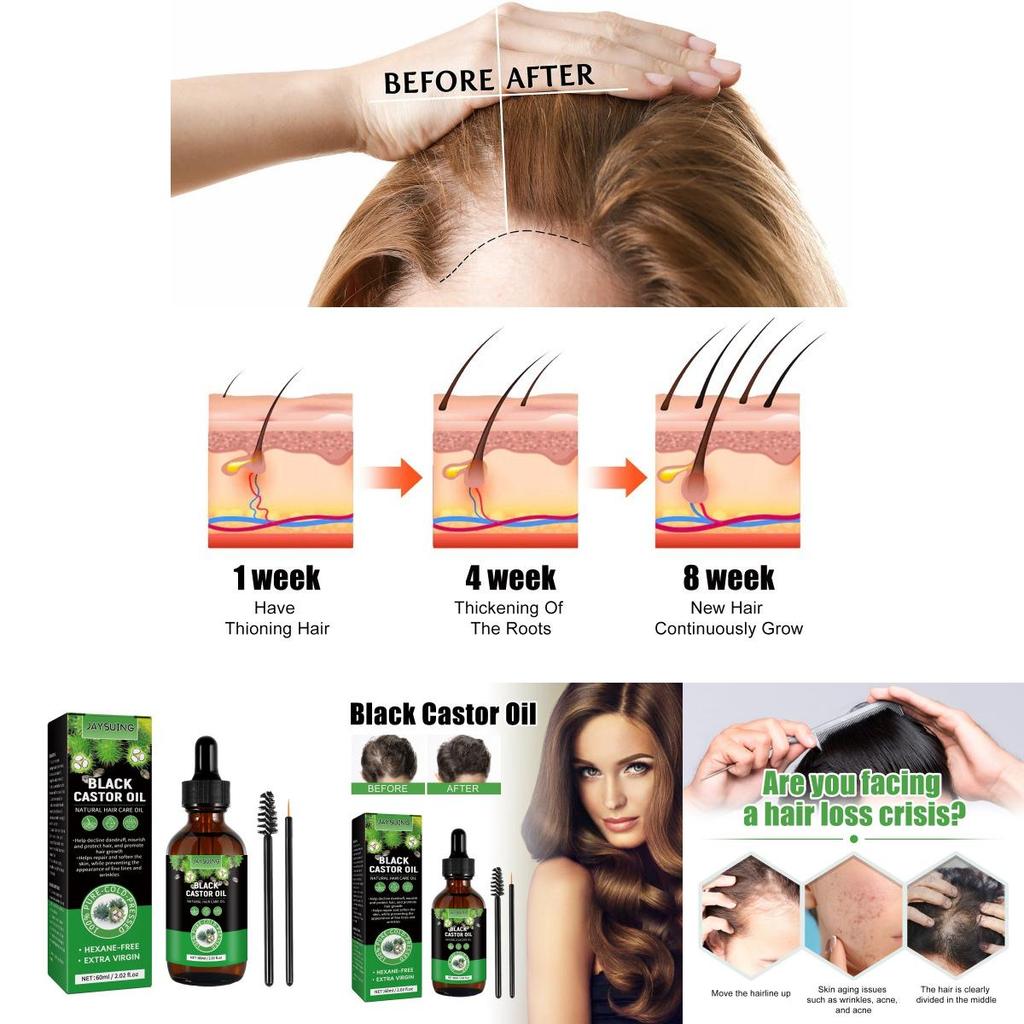 Jaysuing Castor Oil Hair Growth Serum Nourishing Moisturizing Anti Hair Loss 60ml