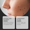 Portable Laser Skin Care Pen for Blemish Removal & Skin Cleansing