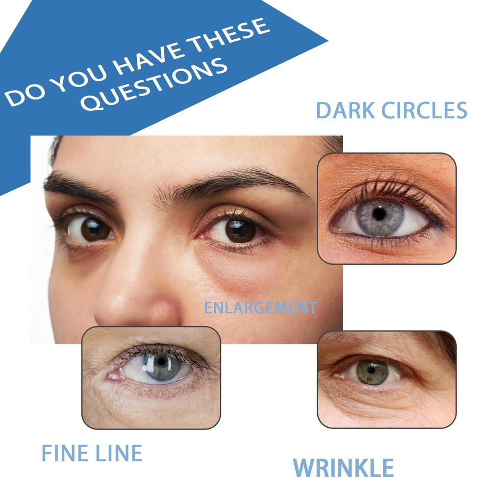 Peptide Eye Serum Reduce Fine Line Dark Circle Improve Skin Elasticity Crow’s Feet Eye Bag Removal Anti-Puffiness Under Eye Care