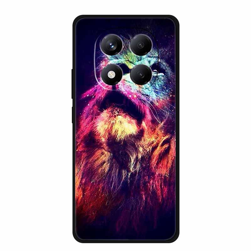 For Redmi Note 15 Case China Version 6.77" Camera Lens Protector Silicone Soft Cover Funda for Redmi Note 15 5G Coque New Note15