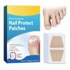 Hands And Feet Soft Nail Inlaid Nail Thickening Bright Nail Furrow Gray Nail Care Patch