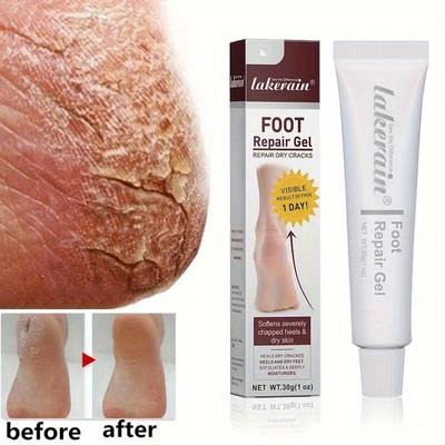 Crème pieds gercés automne et hiver talon Anti-fissure sèche hydratante Gel réparateur pour les pieds