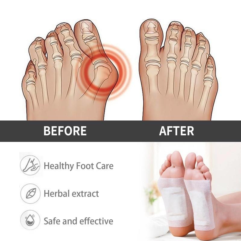 South Moon10pcs For Deep Cleansing And Joint Pain Relief With Herbal Ingredients