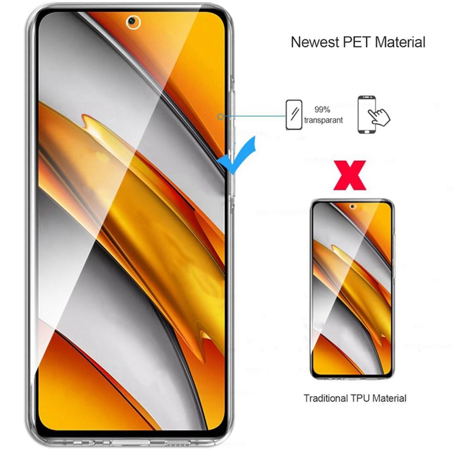 360 Grad Vollkörperschutzhülle Für Xiaomi Poco M6 X6 C65 X7 F7 C85 Redmi 13C 15C 14C 15 Note 14 10 12 Pro 14T 15T 13 11 Doppelseitige Klare Abdeckung
