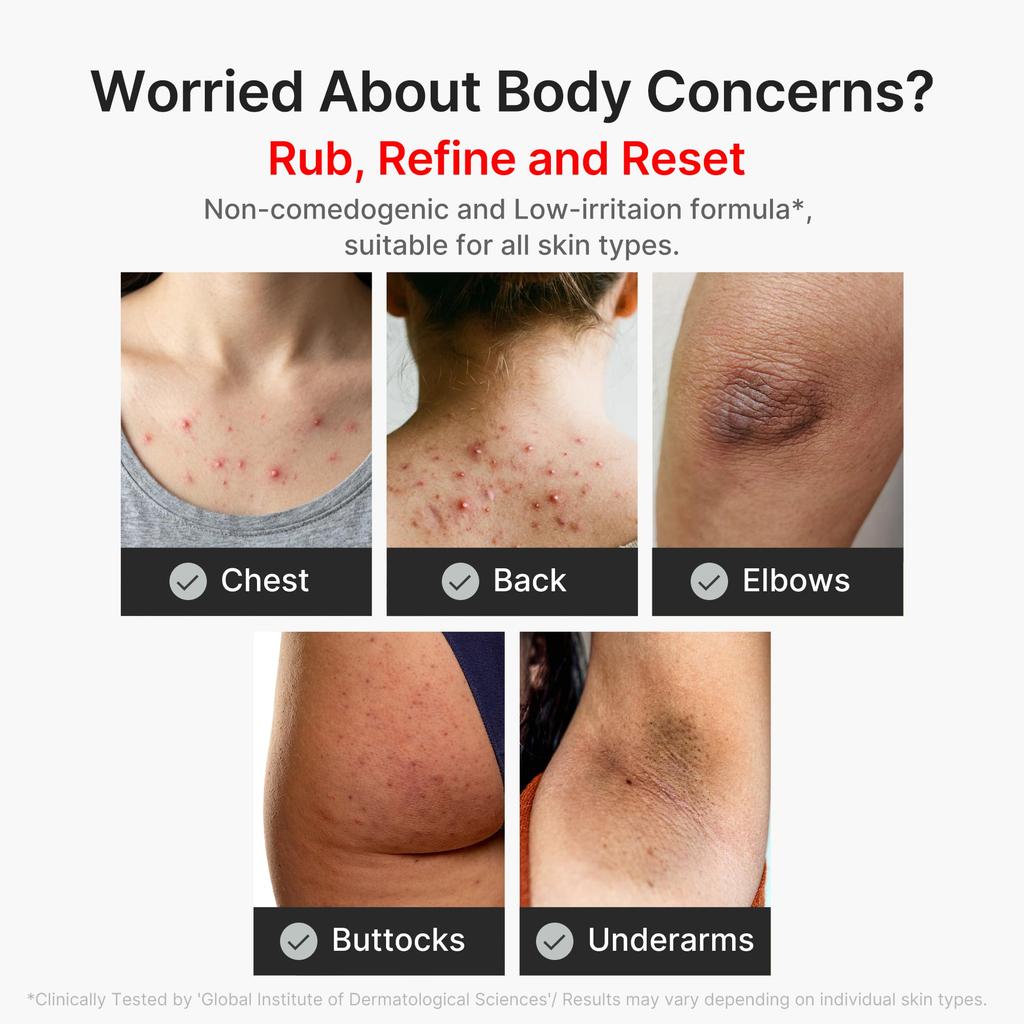 Medicube Kojic Acid Vita Body Peel Shot Large Capacity Body Gommage Peeling Dullness Keratin Summer Measures